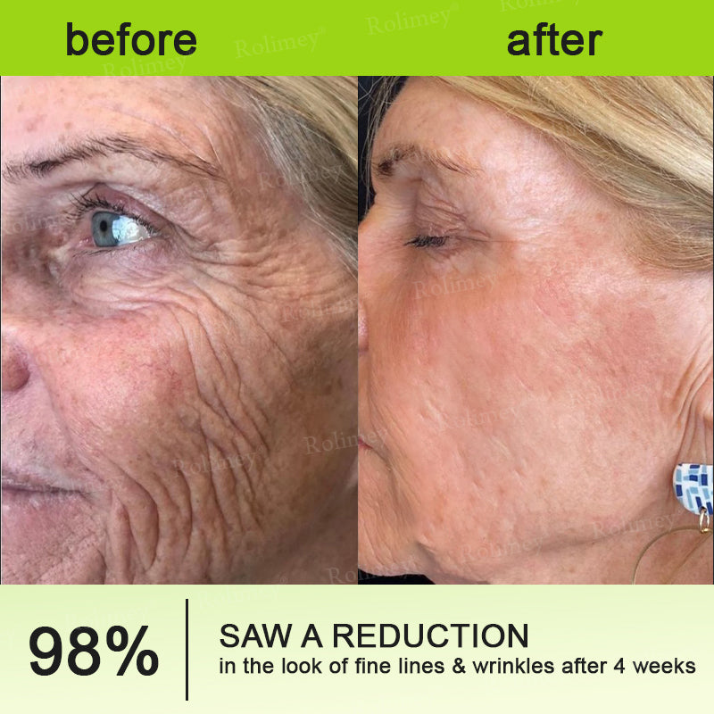 🌹Made and shipped from the CA 💫Rolimey® Botox & Vita-A Retinol Shot Wrinkle-Lift Tightening cream - Last Day Promotion 70% OFF