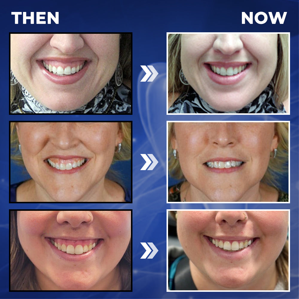 Rolimey® BeeTakt Bee Venom Dental Treatment Drops Mouthwash